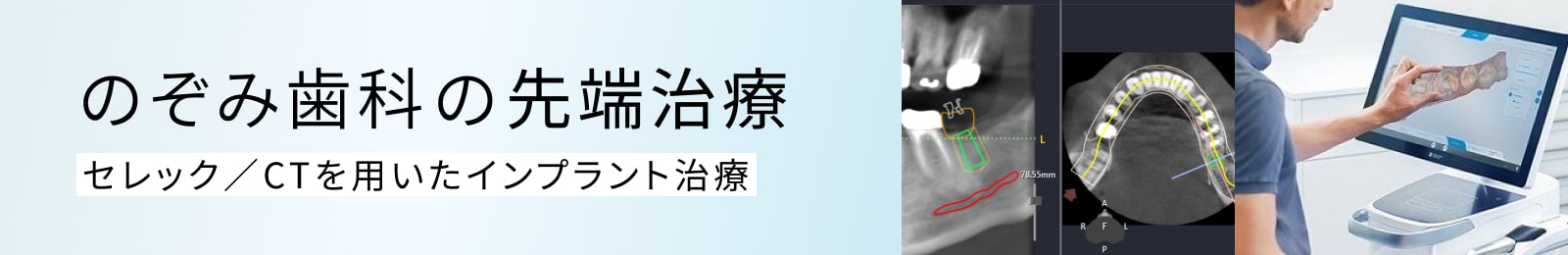 のぞみ歯科の先端治療 セレック／CTを用いたインプラント治療